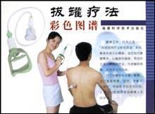 拔罐療法彩色圖譜 拔罐療法彩色圖譜