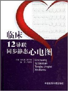 臨床12導聯同步靜態心電圖 臨床12導聯同步靜態心電圖