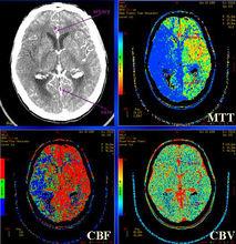 賴德&middot;奧爾巴赫