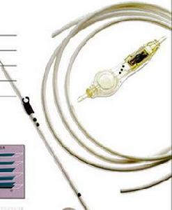 腦室腹腔分流管 腦室腹腔分流管