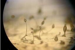 嗜腖高溫放線菌 嗜腖高溫放線菌