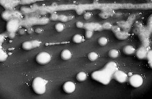 體視顯微鏡下的“超級細菌”菌落