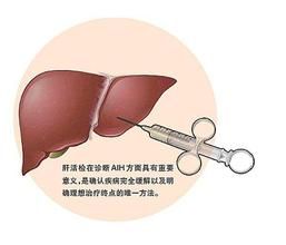 自身免疫性肝炎