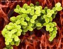 單核細胞增生李斯特菌