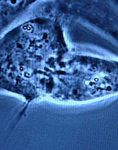 老年再生障礙性貧血