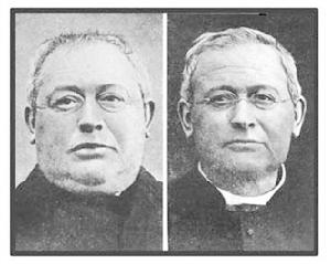 甲狀腺功能衰退