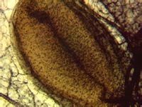 環層小體 環層小體