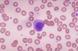 單核細胞(M,MONO) 單核細胞(M,MONO)