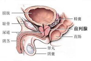 睪丸腫脹 睪丸腫脹