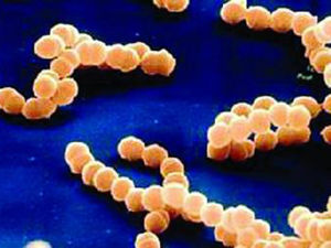 金黃色葡萄球菌