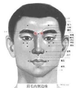 攢竹穴[人體經穴名]