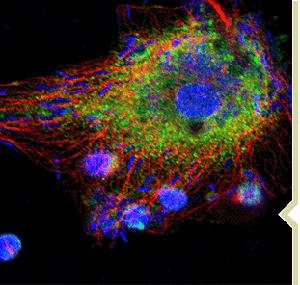 非甾體類抗炎藥物性腎病
