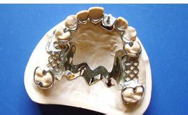 鈷鉻合金烤瓷牙 鈷鉻合金烤瓷牙