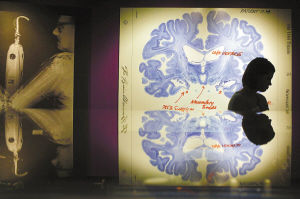 大腦進化極限 大腦進化極限