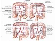 示意圖11:選擇要移植的結腸段