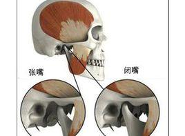 習慣性下巴脫臼 習慣性下巴脫臼
