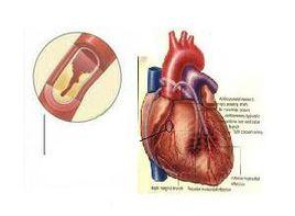 周圍組織灌注不良 周圍組織灌注不良