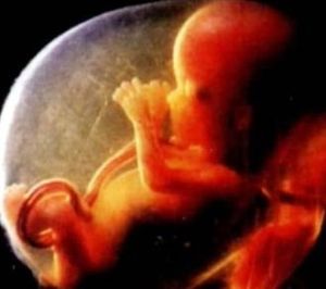 母體抗體 母體抗體