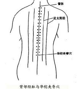 華佗夾脊穴 華佗夾脊穴