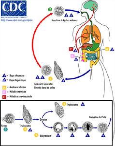 急性細菌性痢疾 急性細菌性痢疾