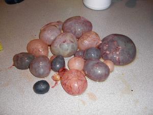 囊性腫瘤及囊腫 囊性腫瘤及囊腫