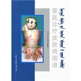 蒙醫診療皮膚病圖譜 蒙醫診療皮膚病圖譜