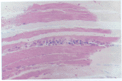（圖）病理表現