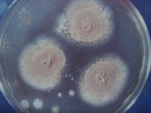 土麴黴金色變種 土麴黴金色變種
