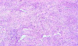 纖維組織 纖維組織