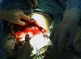 血性惡露持續時間延長 血性惡露持續時間延長