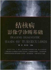 結核病影像學診斷基礎 結核病影像學診斷基礎