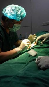 自體達拉斯隆鼻