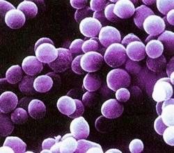 副球菌屬 副球菌屬