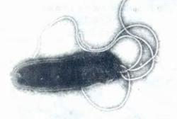 清除幽門螺旋桿菌 清除幽門螺旋桿菌