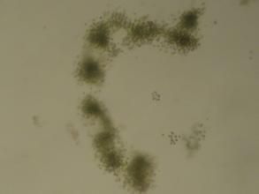 坑形席藻 坑形席藻