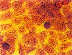 衣原體陽性 衣原體陽性