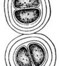 束縛色球藻 束縛色球藻