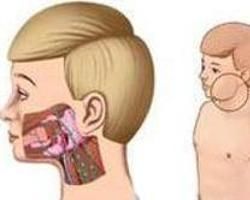 腮腺隙感染 腮腺隙感染