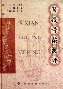 X線骨齡測評 X線骨齡測評
