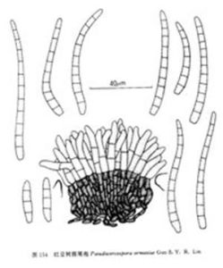 卵孢膠盤耳 卵孢膠盤耳
