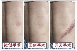 德國太空制導雙定位體外碎石技術 德國太空制導雙定位體外碎石技術