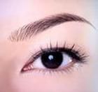 眉弓假體植入術 眉弓假體植入術