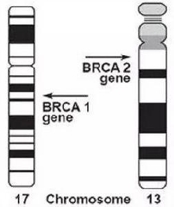 BRCA1基因 BRCA1基因
