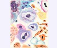 哈拉爾德&middot;楚爾&middot;豪森