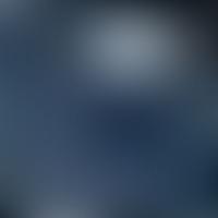 IC 1042 RASS 彩色圖