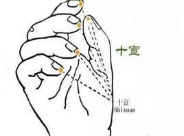 十宣穴 十宣穴