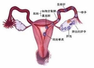 子宮輸卵管造影