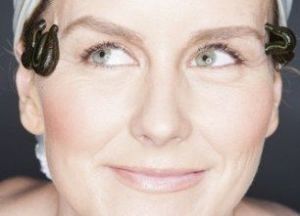 水蛭療法 水蛭療法