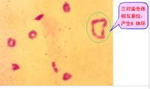 染色體相互易位