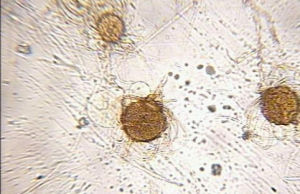 犁頭霉屬 犁頭霉屬